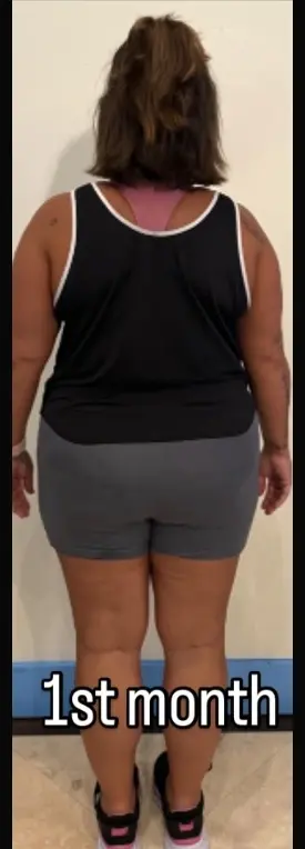 Client rear view at Month 1