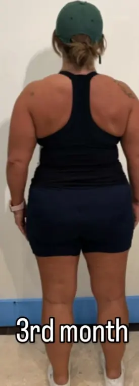 The same client’s rear view at Month 3